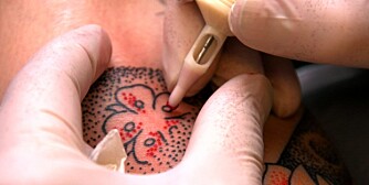 PRIKKER: Denne teknikken gir andre muligheter enn ""vanlig"" tatovering med hele fylte felter.