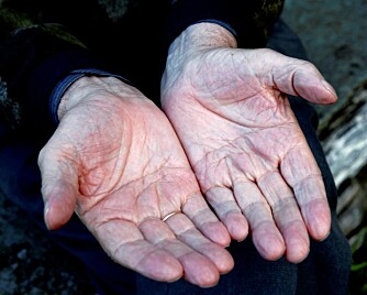 Her er de mest omtalte hendene i Norge for tiden. Joralf har lagt disse hendene på tusenvis av personer for å lindre plagene deres.