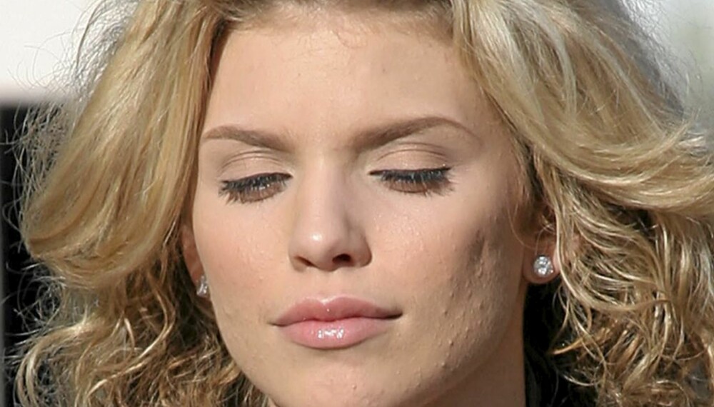 90210-stjernen AnnaLynne McCord er talskvinne for kvisenettstedet AcneHeroes.com.