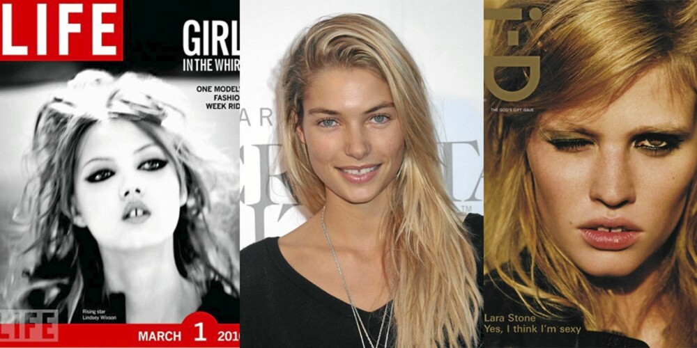 MELLOMROM MELLOM TENNENE: De hotte modellene Lindsey Wixson, Jessica Hart og Lara Stone har alle tydelig glippe mellom tennene. MELLOMROM MELLOM TENNENE: De hotte modellene Lindsey Wixson, Jessica Hart og Lara Stone har alle tydelig glippe mellom tennene.