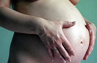 DE FLESTE FÅR STREKKMERKER: 90 prosent av alle gravide får strekkmerker mot slutten av graviditeten. Totalt vil 70 prosent av alle kvinner få strekkmerker etter puberteten.