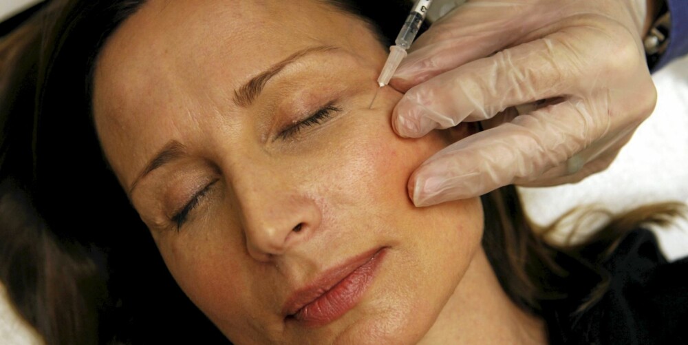 BOTOX: Du bør vente med Botox til du har synlige rynker i ansiktet mens det er i ro, råder hudlegen. Foto: AP