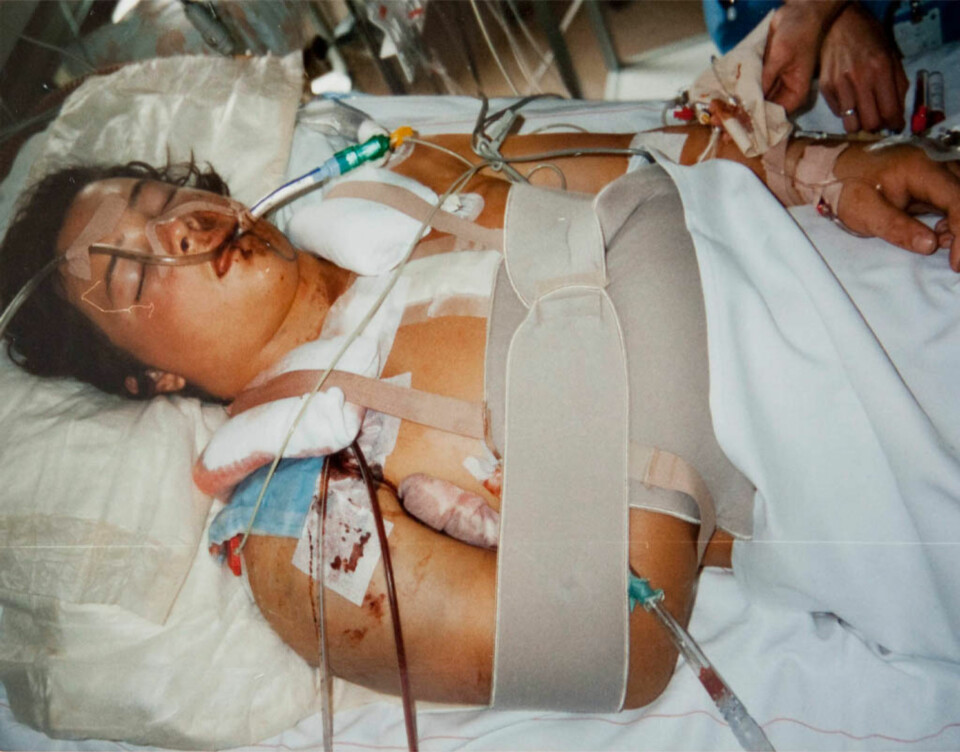 SMÅ SJANSER: Legene på St. Olavs Hospital har fortalt Håvard at han overlevde mot alle odds.