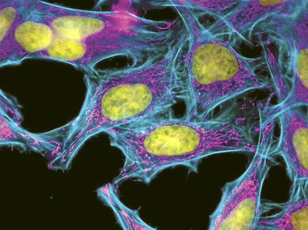 Mikroskopbilde av HeLa-celler som er i ferd med å dele seg i to. Familien har aldri fått noen kompensasjon for den verdifulle forskningen Henriettas kropp har bidratt til.