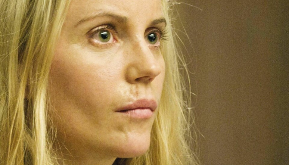 SYNLIGE ARR: I dag er det kun arret over overleppen og på høyre side av haken som er synlige tegn etter sykkelulykken Sofia Helin opplevde for 15 år siden.