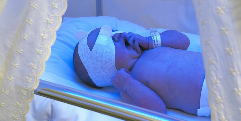GULSOTT: Nesten halvparten av de nyfødte får gulsott. De færreste trenger behandling.