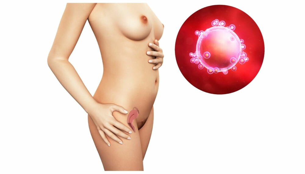 GRAVID UKE 1: Omtrent slik ser en eggcelle ut når den ikke er befruktet. GRAVID UKE 1: Omtrent slik ser en eggcelle ut når den ikke er befruktet.