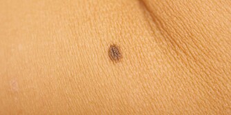 FØFLEKK: Slik detaljer har ingenting med sexen dere har å gjøre. ILLUSTRASJONSFOTO: Colourbox FØFLEKK: Slik detaljer har ingenting med sexen dere har å gjøre. ILLUSTRASJONSFOTO: Colourbox