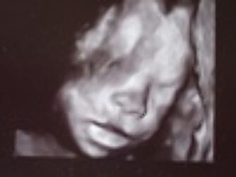 LIK PÅ MAMMA: På ultralyden kunne Heidi se at Elida lignet på henne.
