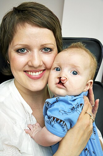 MOR OG SØNN: En stolt mamma Hanne med sønnen Marius - før operasjonene.