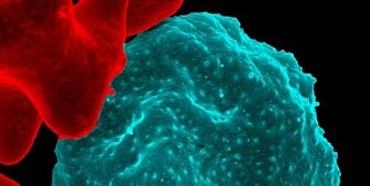 SYK: En malaria-infisert rød blodcelle.