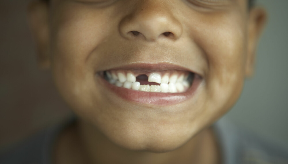 BARN OG TENNER: Når kommer 6-årsjekselen? Og når kommer 12-årsjekselen? Vi gir deg oversikten over alt du trenger å vite om barnas tenner. FOTO: Getty Images.