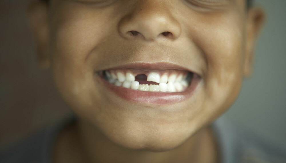 BARN OG TENNER: Når kommer 6-årsjekselen? Og når kommer 12-årsjekselen? Vi gir deg oversikten over alt du trenger å vite om barnas tenner. FOTO: Getty Images. BARN OG TENNER: Når kommer 6-årsjekselen? Og når kommer 12-årsjekselen? Vi gir deg oversikten over alt du trenger å vite om barnas tenner. FOTO: Getty Images.