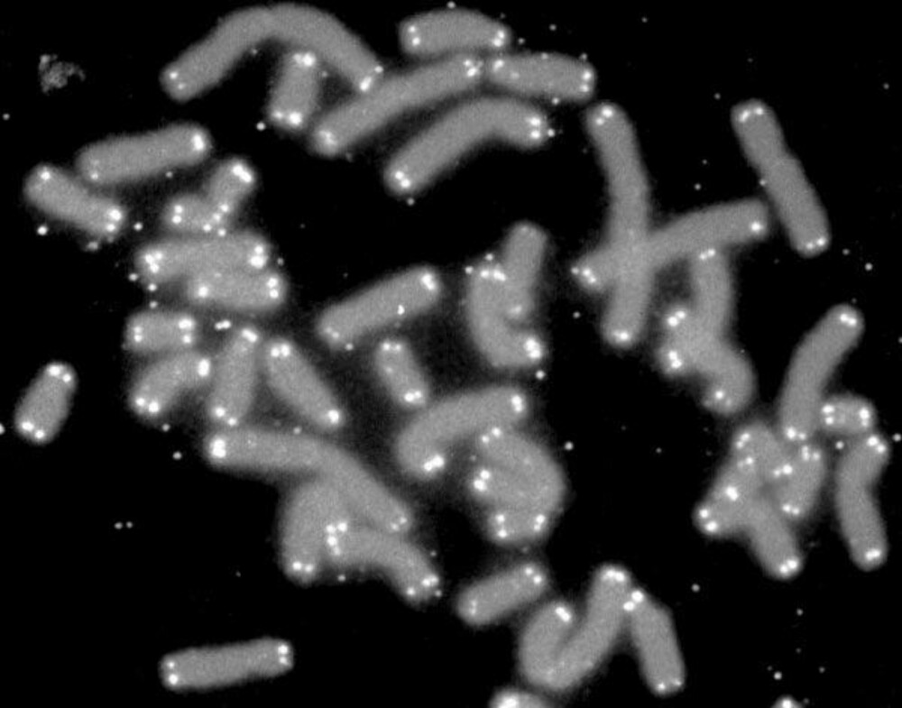 TELOMERENE: Menneskelige kromosomer i grått med det beskyttende lokket telomer i hvitt.