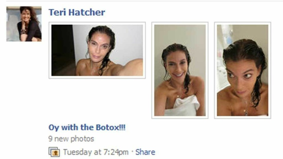 Farvel til Botox