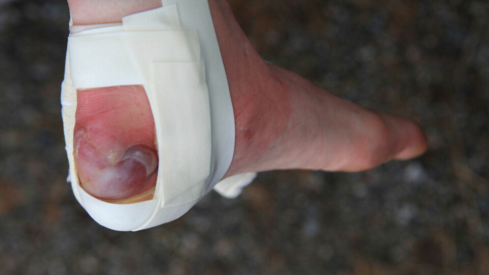 - Det var forferdelig