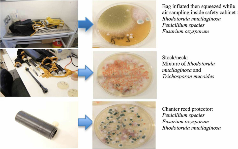 DØDELIGE DOSER: Legene testet mannens sekkepipe og fant en blanding av muggsopp-artene Paecilomyces variotti, Fusarium oxysporum, Rhodotorula mucilaginosa, og Penicillium inne i sekkepipens blåsebelg.