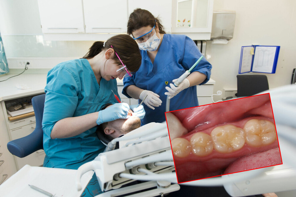 Mette Johansen ser ofte pasienter som har syreskader på tennene sine. -Det viktig å fokusere på tannhelsen, sier hun. Her med tannhelsesekretær Anniken Pettersen.