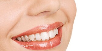 FLOTTE TENNER: Din egen innsats med tannbørste, tanntråd og fluor har mye å si for tannhelsen. © Illustrasjonsfoto: Colourbox