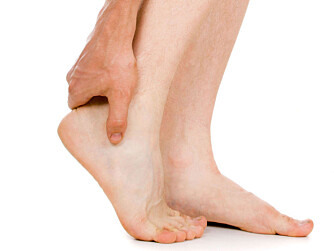 PLAGSOMT: Stell pent med beina dine for å unngå unødvendige soppinfeksjoner og smerter.