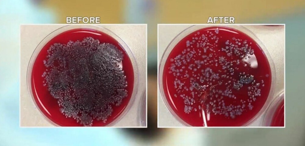 TEST 1 MED ANTIBAK: I den første testen brukte reporteren kun en liten mengde med antibakteriell på hendene. Til venstre ser man prøvekoppen før han brukte en liten mengde antibakteriell på hendene. Til høyre ser man resultatet etter. De svarte flekkene er E- coli-bakterier.