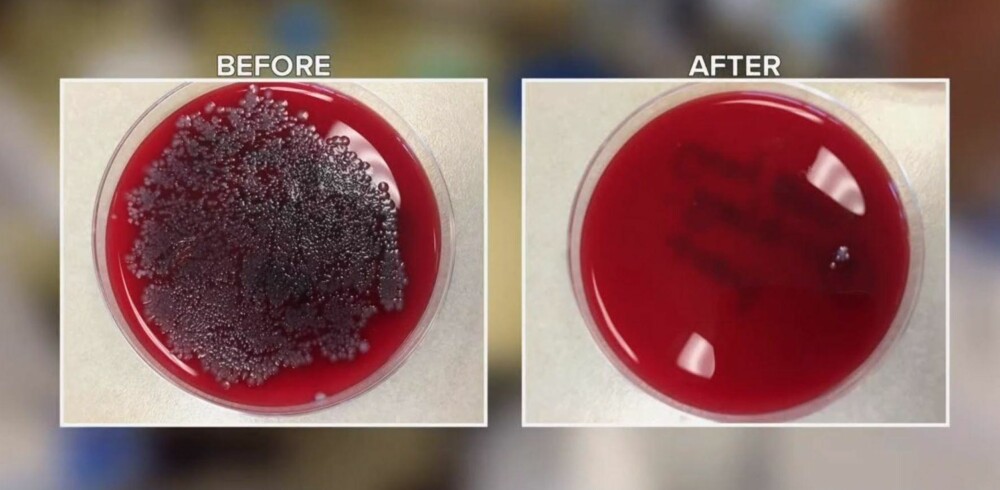 TEST 2: En stor dose antibakteriell var helt klart det mest effektive middelet mot bakterier. Til venstre er testkoppen der det svarte er E. colo.-baktereier. I koppen til høyre er bakteriene nesten borte.