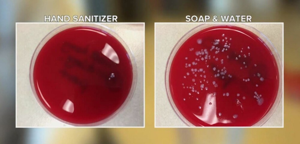 ENDELIG RESULTAT: Til slutt sammenlignet man effektiviteten av antibakteriell mot en god vask med varmt vann og såpe.