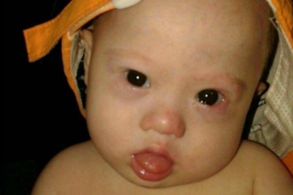 FORLATT: Seks måneder gamle Gammy ble forlatt av sine foreldre hos surrogatmoren i Thailand. De ønsket bare å beholde guttens friske tvillingsøster.