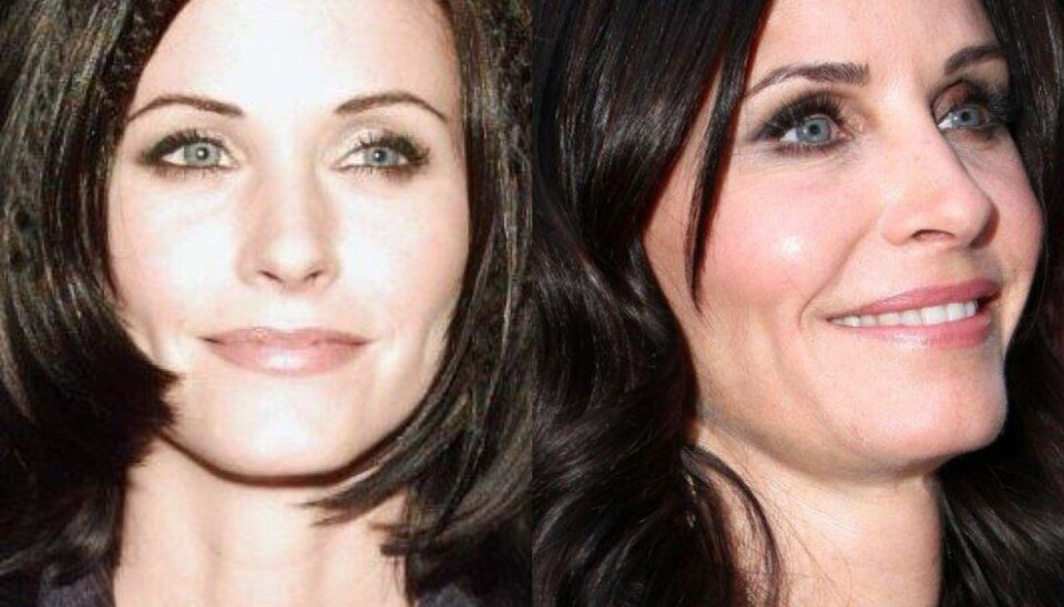 12 kjendiser som er FOR glad i botox!