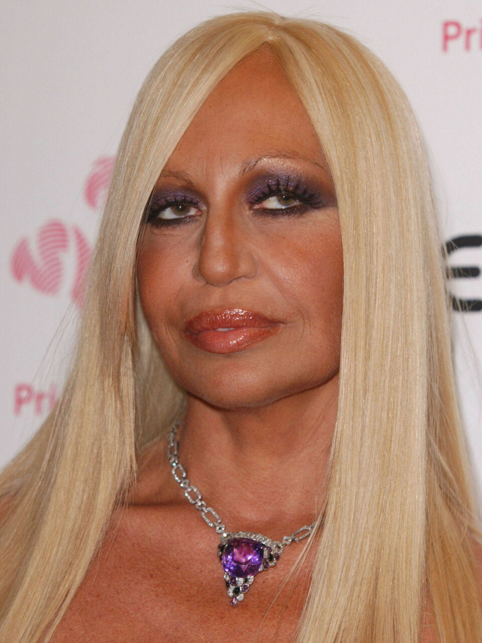 Hva har skjedd med Donatella Versace?