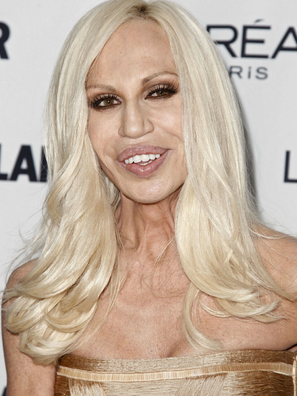 Hva har skjedd med Donatella Versace?