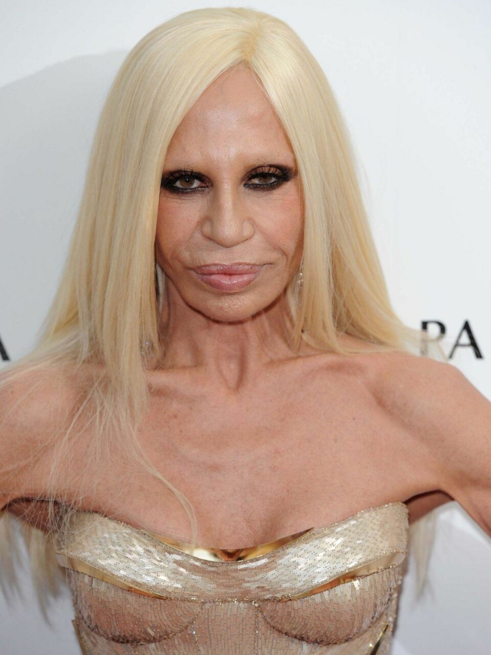 Hva har skjedd med Donatella Versace?