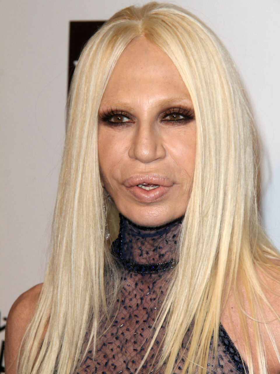 Hva har skjedd med Donatella Versace?