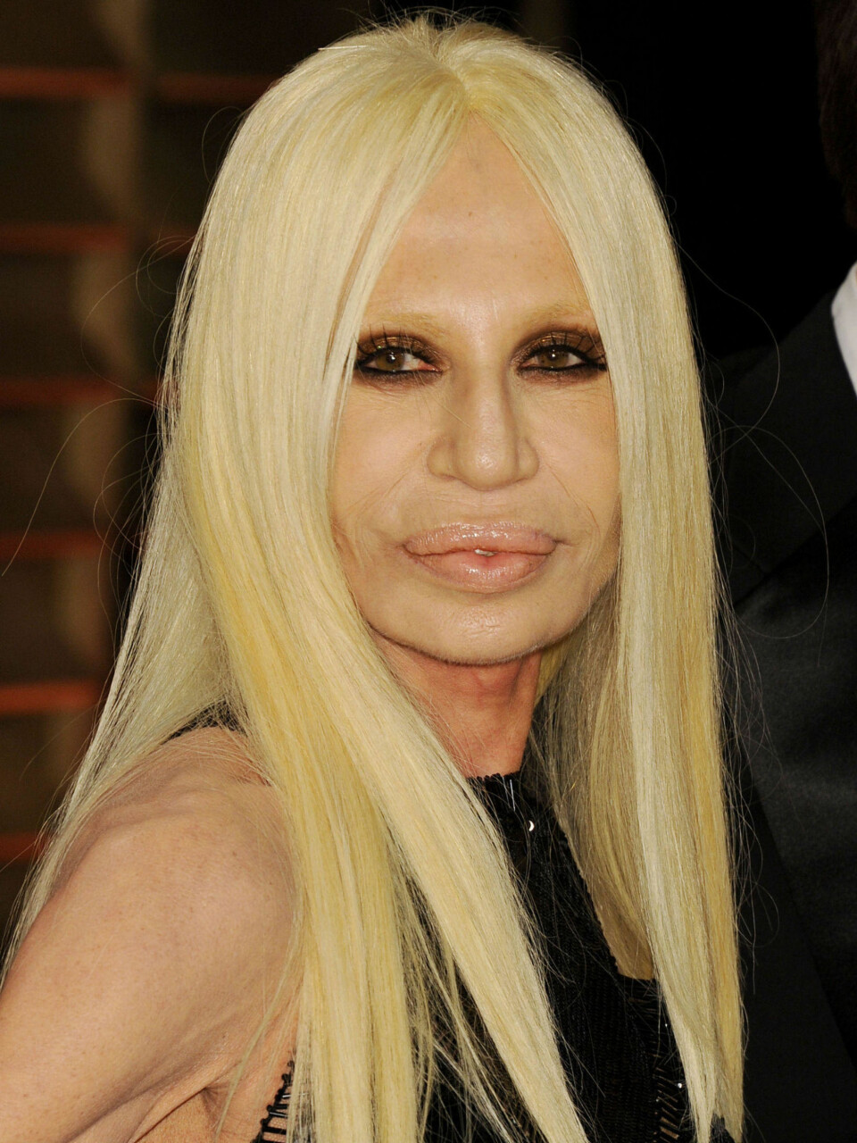 Hva har skjedd med Donatella Versace?
