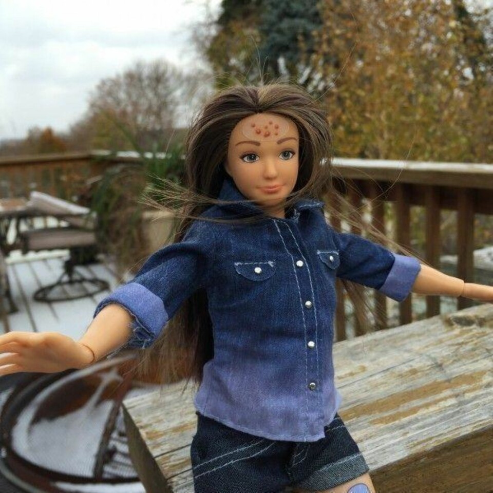«Normale Barbie» har cellulitter og kviser