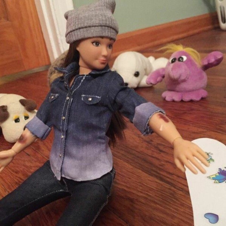 «Normale Barbie» har cellulitter og kviser