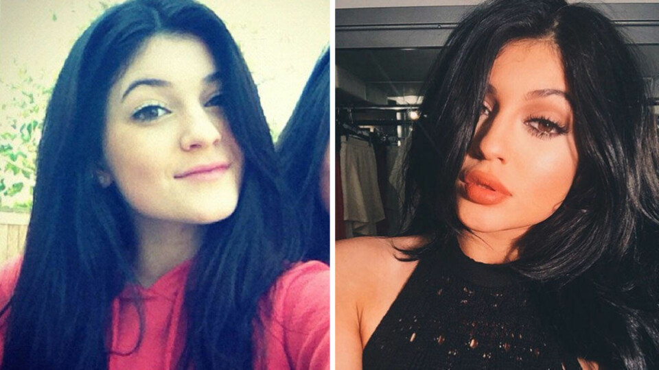FRA 14 til 17 år: Kylie er seg selv lik, men det er også flere trekk i ansiktet som er endret de siste tre årene. Selv hevder hun å kun sminke seg annerledes.