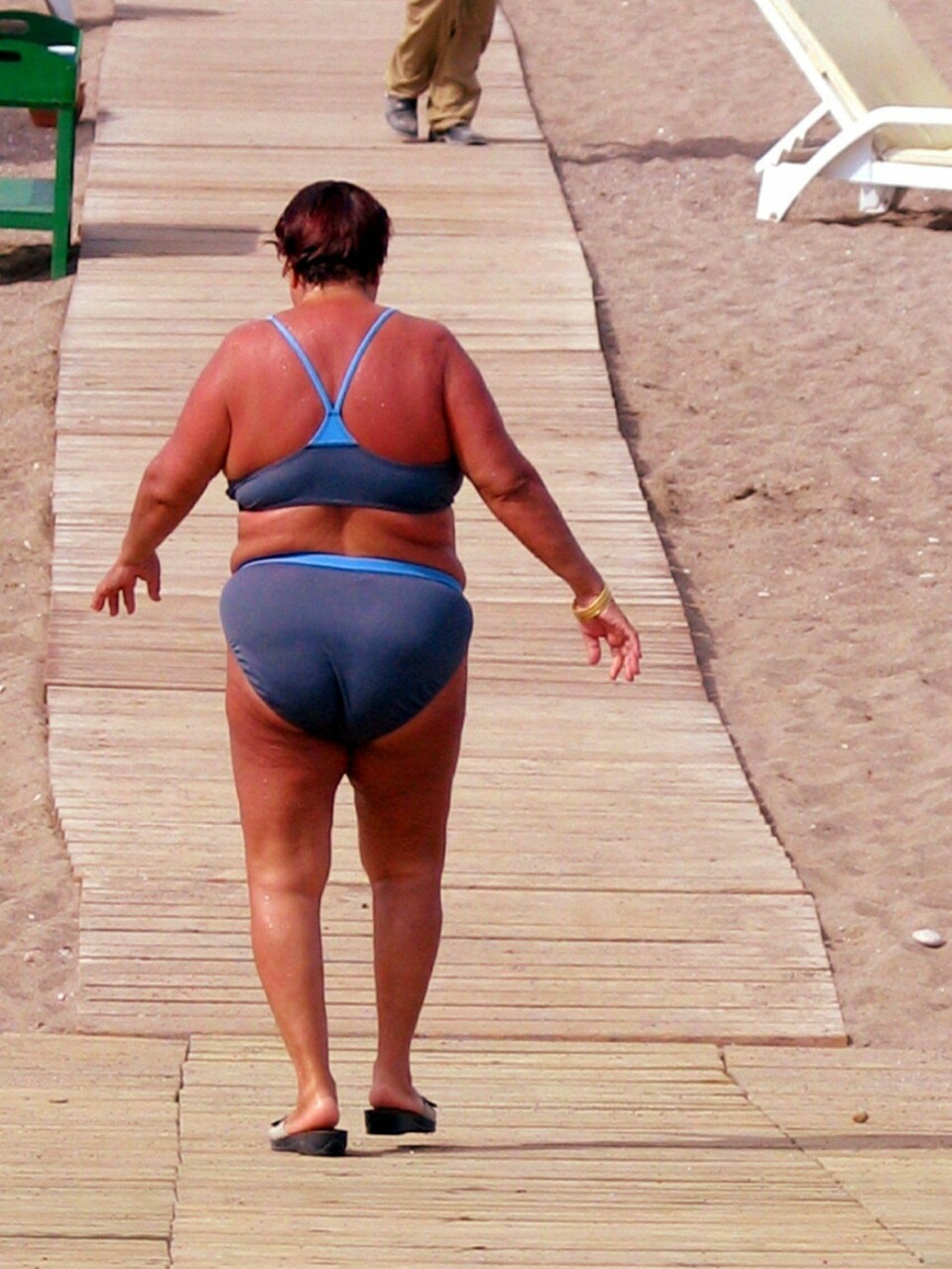 SOLBRENT I SYDEN: Du er ikke nordmann på sydentur før du har blitt skikkelig solbrent (illustrasjonsbilde).