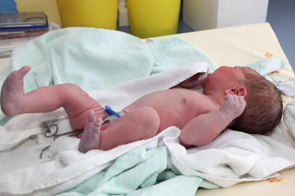 NYFØDT: Et liten guttebaby i Mexico fikk et tøft førstemøte med virkeligen og måtte sys kort tid etter at han ble født.