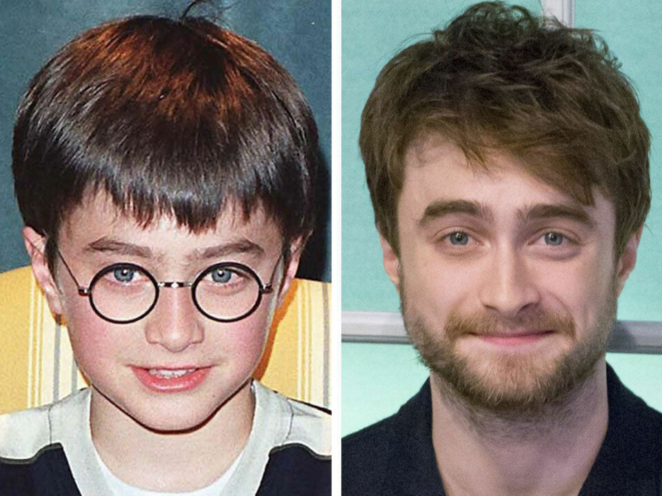 Daniel Radcliffe: Nå ser han ikke lenger slik ut – eller slik