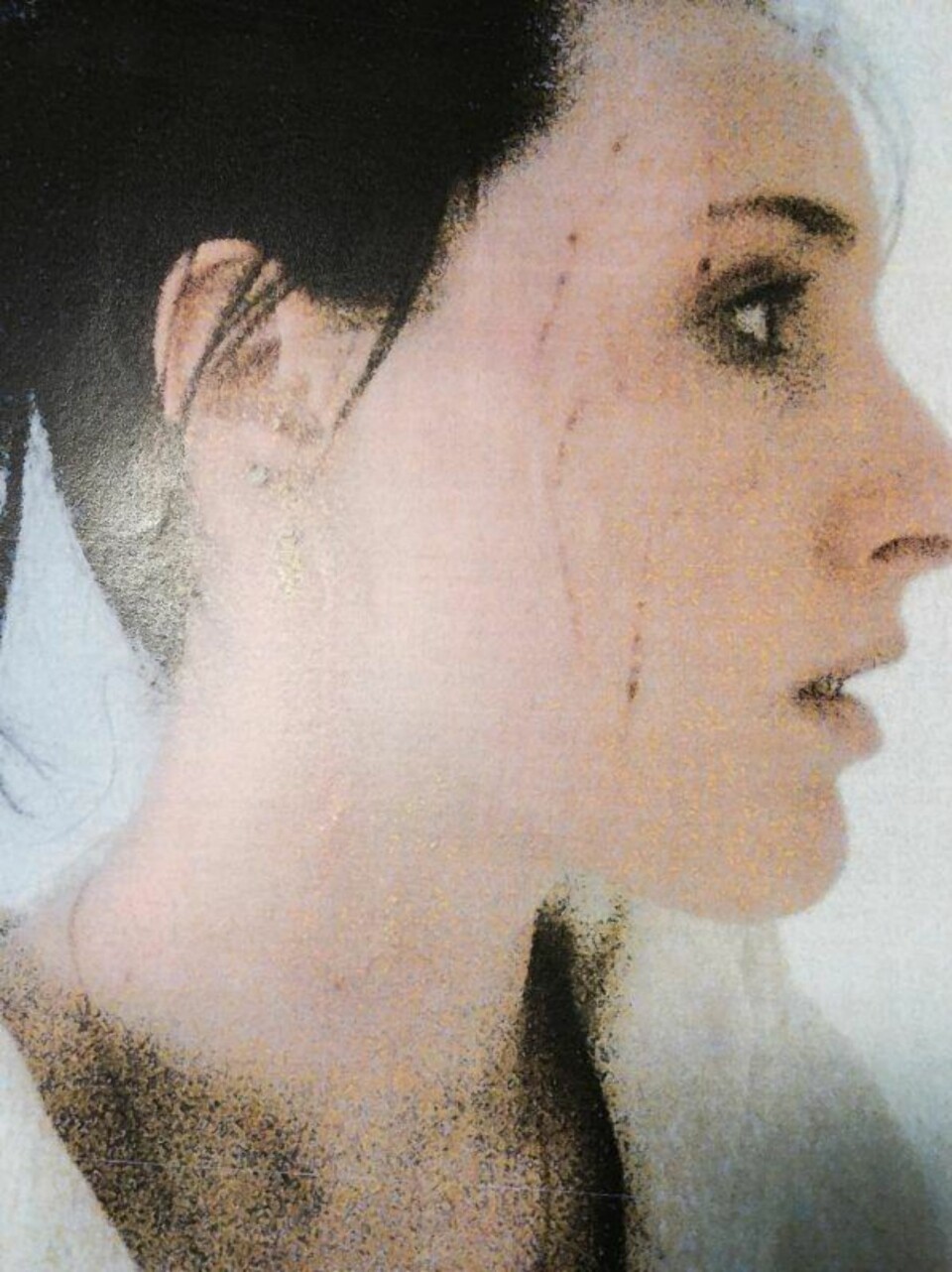 Camilla (19) ble overfalt med kniv og voldtatt: - Politiet mente jeg hadde gjort det med et sexleketøy