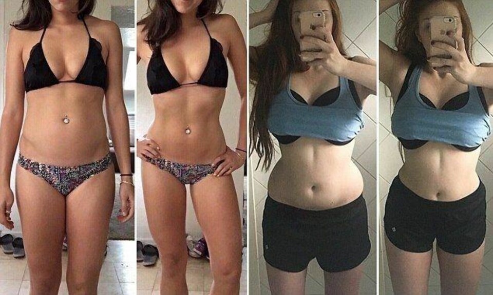 «JUKS»: Suge inn magen og vri kroppen - så ser man straks mer «perfekt» ut. Hashtagen 30secondsbeforeandafter trender på Instagram.