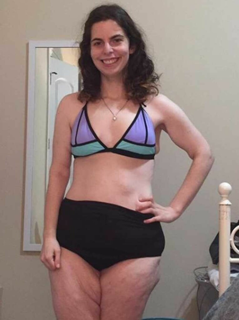 Lesley måtte bli 21 år før hun turte å gå i bikini uten å være redd for at kroppen hennes ikke skulle få «sosial aksept».