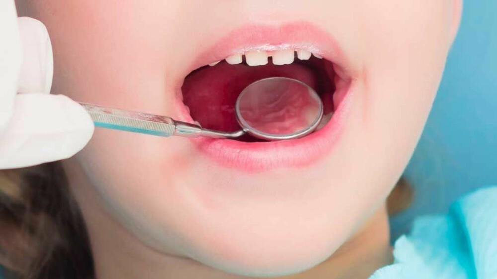 Nå skal små barn få undersøkelse av tennene allerede ved 2 års alder.