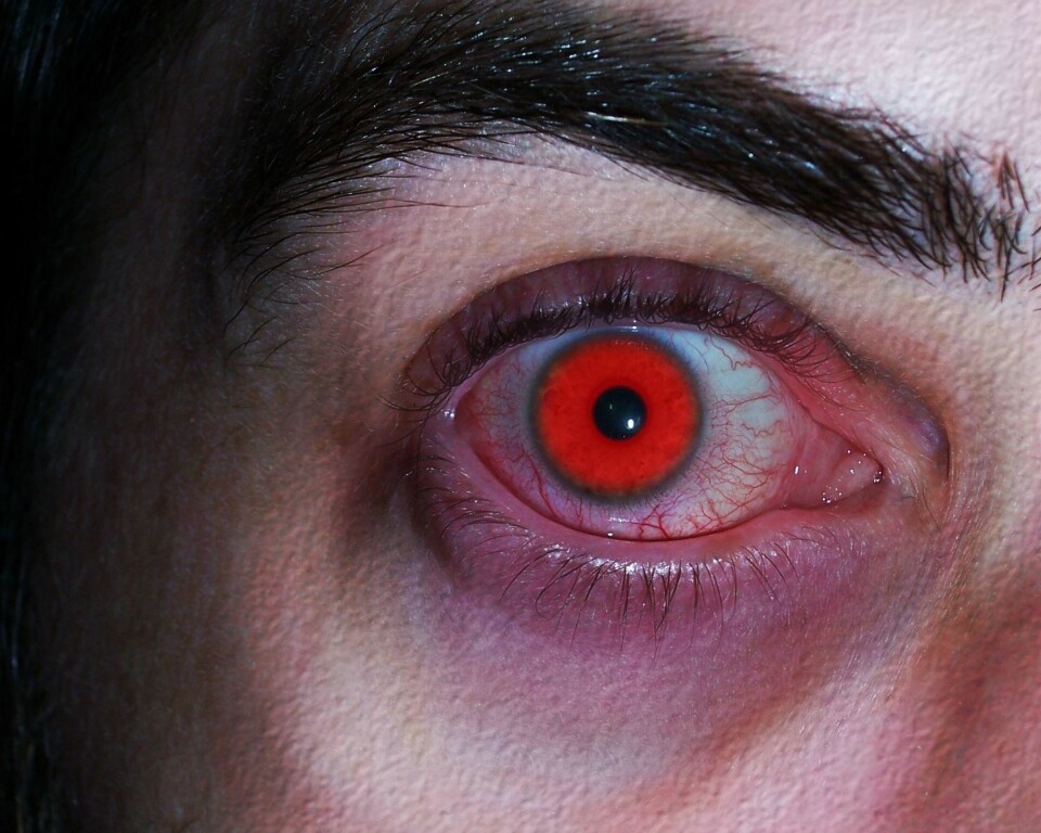 Fargelinser til Halloween kan gi alvorlige øyeskader