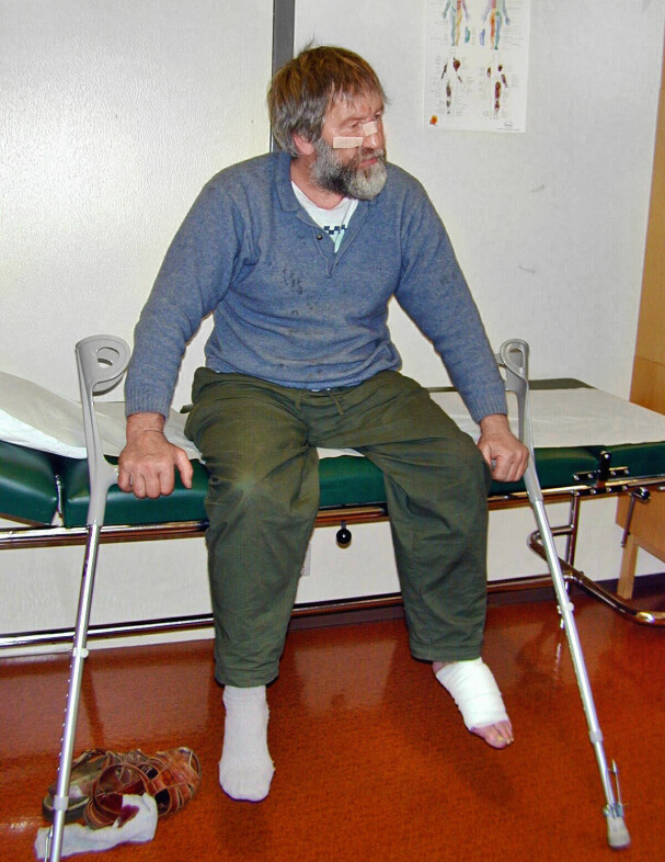 <b>SKADET:</b> Arne Sigmund Øvergård fra Flendalen i Trysil havnet i slåsskamp med en voksen hannbjørn i august 2000. Han kom unna med skrekken, noen skrammer og et bitt i venstre fot.
