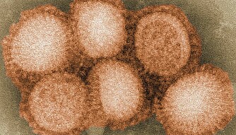 <b>SMÅ, MEN FARLIG:</b> Slik ser spanskesyke-viruset ut.