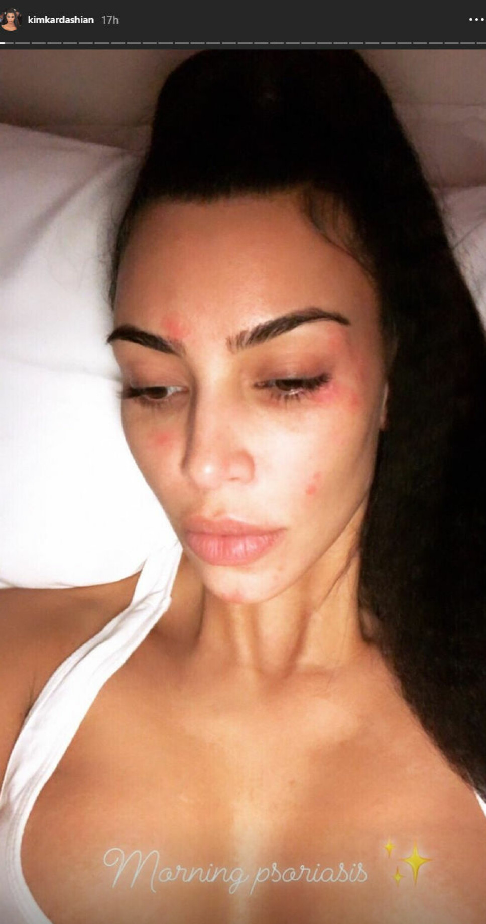 INSTA: Kim Kardashian postet dette nærbildet av huden sin på Instagram story i helgen.