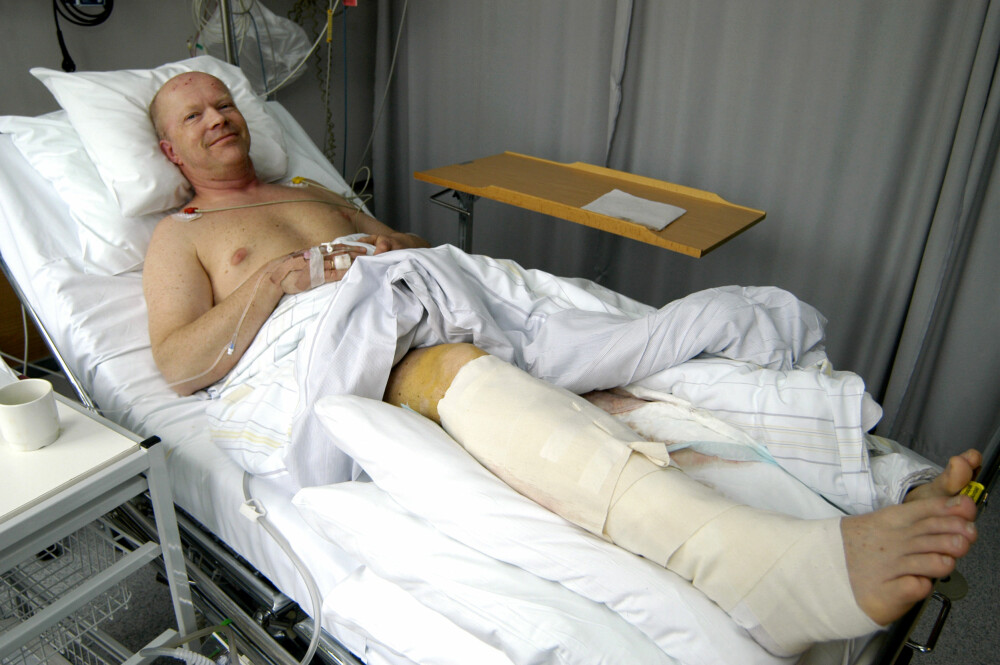 <b>UTEN MÉN:</b> Truls Gjefsen på sykehuset etter ulykken. Det skadede beinet kunne ha kostet ham livet.