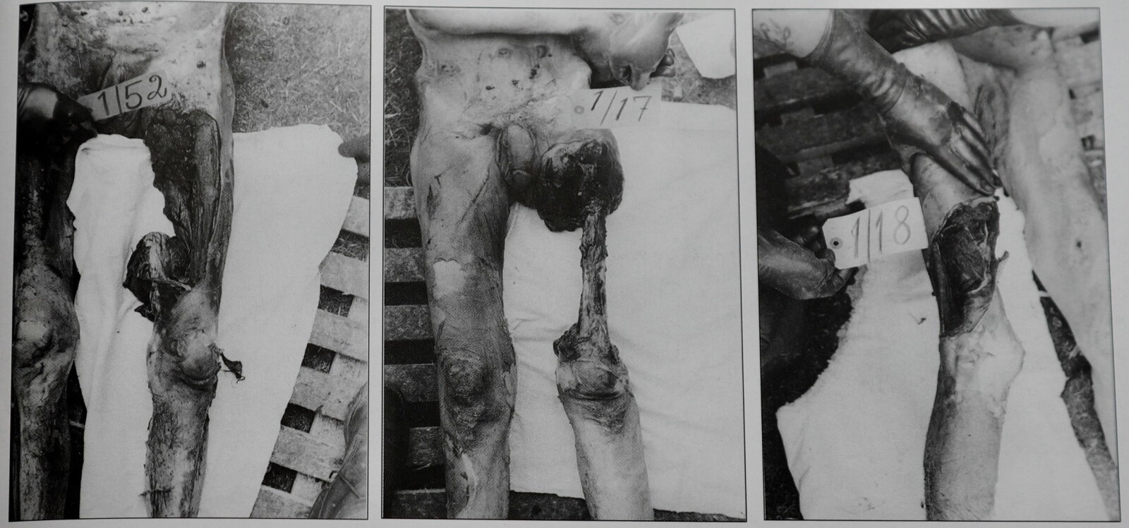 <b>OBDUKSJON:</b> Tause spor etter redslene fangene ble utsatt for i tyskernes fangeleirer i Storfjord ble avdekket under obduksjonene. Disse sporene viste flere eksempler på kannibalisme.